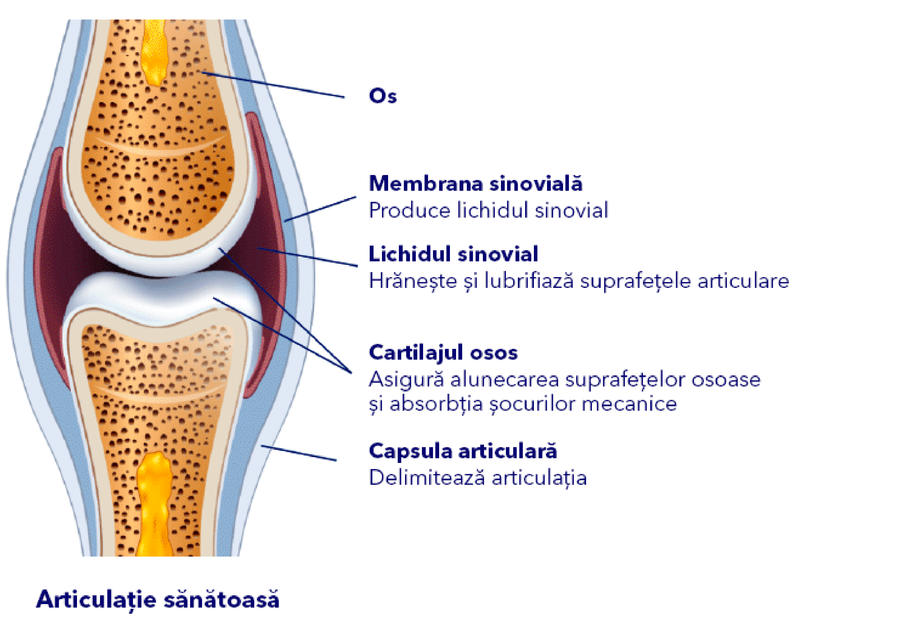articulation sans arthrose